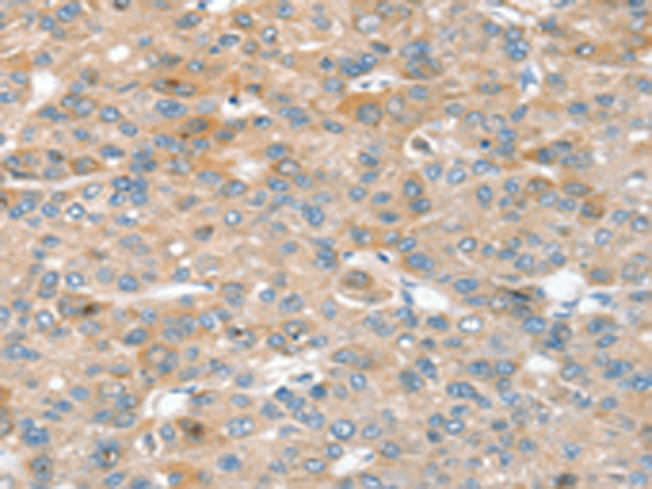 Rabbit Polyclonal Antibody to SIK1