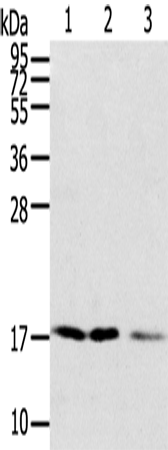 Rabbit Polyclonal Antibody to SNX3