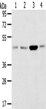 Rabbit Polyclonal Antibody to SNX5