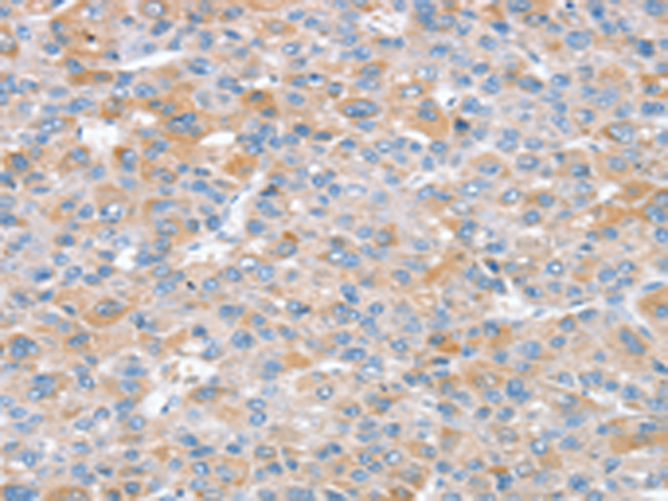 Rabbit Polyclonal Antibody to SNX25