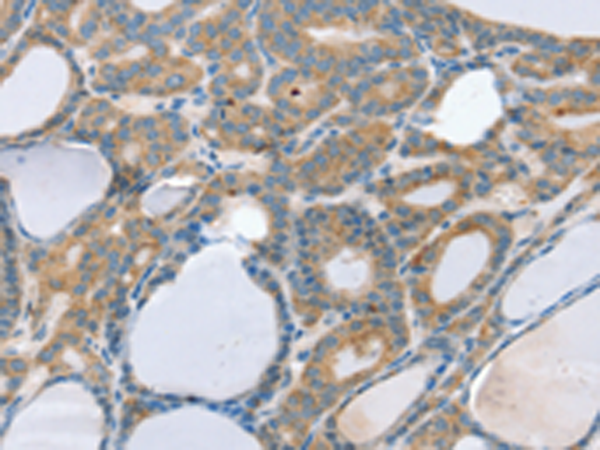 Rabbit Polyclonal Antibody to SNX29