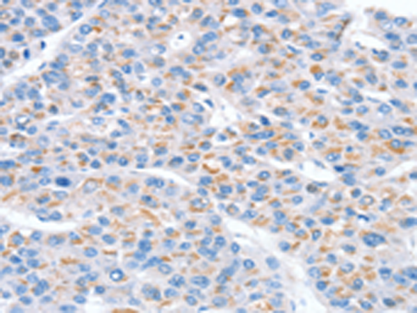 Rabbit Polyclonal Antibody to SNX33