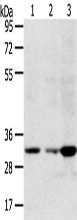 Rabbit Polyclonal Antibody to CCS