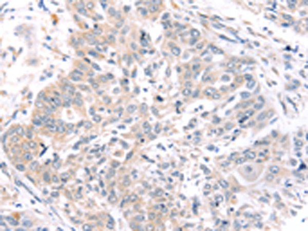 Rabbit Polyclonal Antibody to ROR1