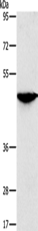 Rabbit Polyclonal Antibody to SOX11