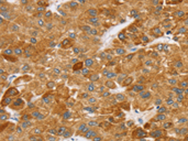Rabbit Polyclonal Antibody to SPARCL1