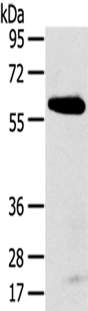 Rabbit Polyclonal Antibody to SPATA18