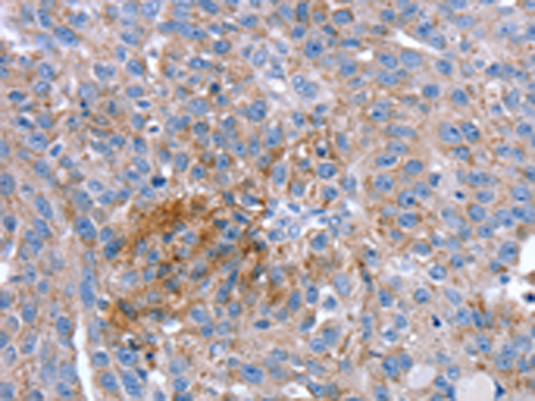 Rabbit Polyclonal Antibody to SPATA5L1