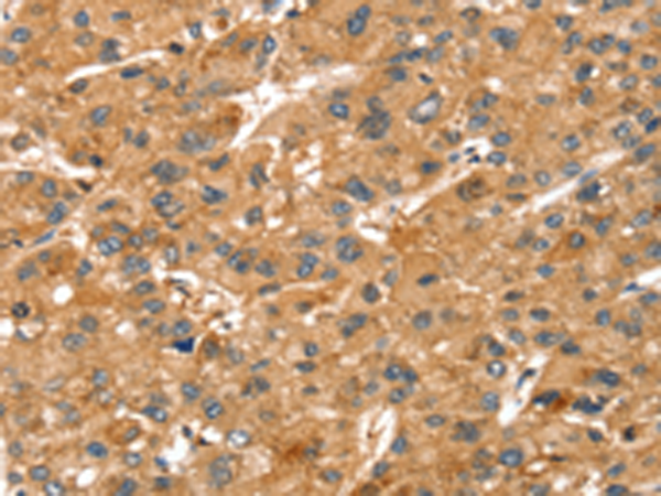 Rabbit Polyclonal Antibody to SPTAN1
