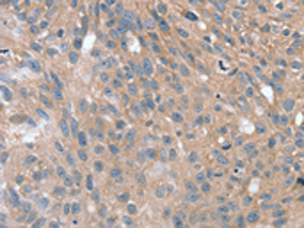 Rabbit Polyclonal Antibody to SPON1