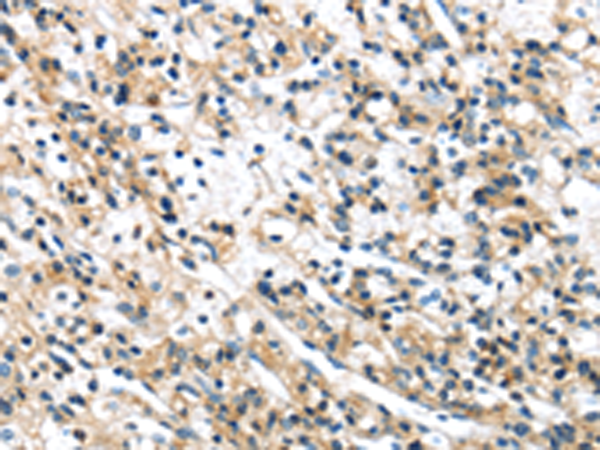 Rabbit Polyclonal Antibody to SPDL1