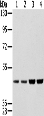 Rabbit Polyclonal Antibody to SSB