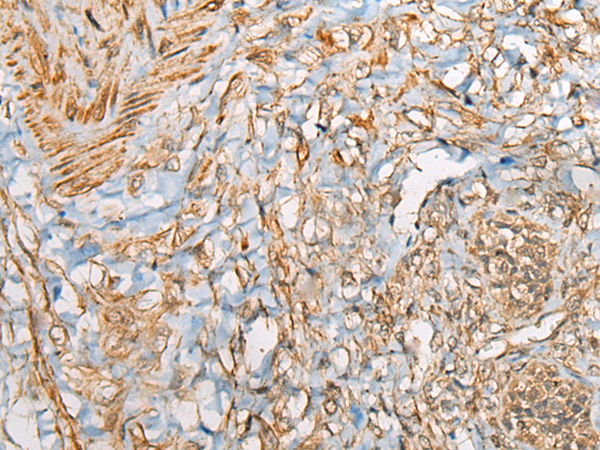 Rabbit Polyclonal Antibody to STS