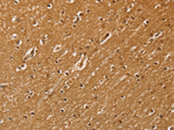 Rabbit Polyclonal Antibody to SSX2