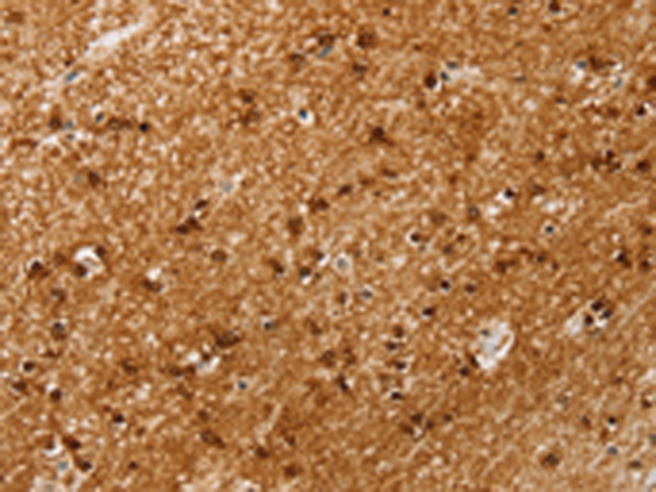 Rabbit Polyclonal Antibody to SSX4