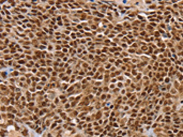 Rabbit Polyclonal Antibody to SSX5