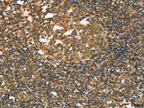 Rabbit Polyclonal Antibody to STAB1