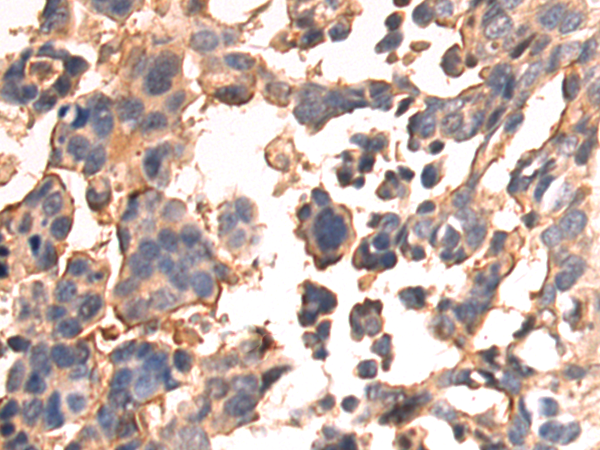 Rabbit Polyclonal Antibody to STARD4