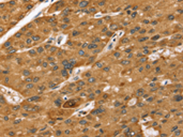 Rabbit Polyclonal Antibody to STARD5