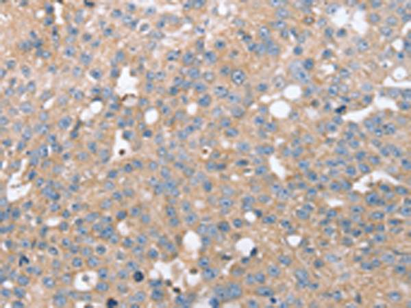 Rabbit Polyclonal Antibody to STK36