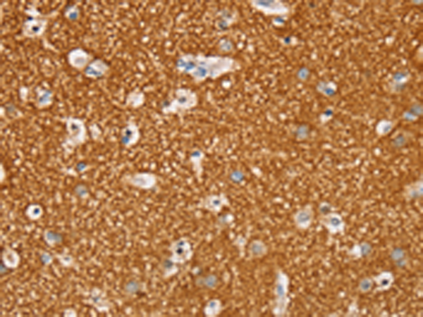 Rabbit Polyclonal Antibody to STK32A