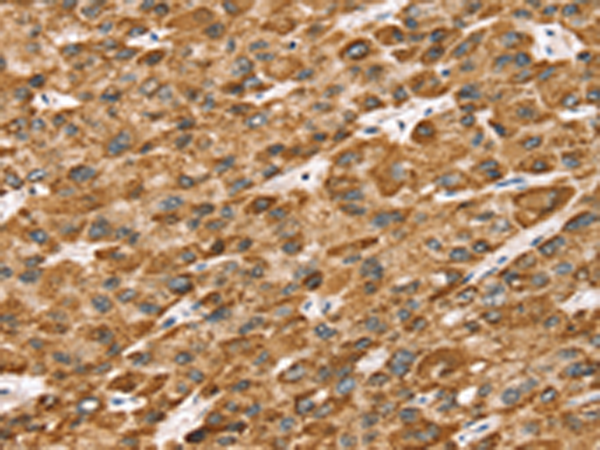 Rabbit Polyclonal Antibody to STK32B
