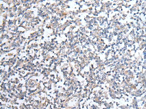 Rabbit Polyclonal Antibody to STK32C