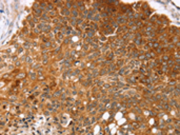 Rabbit Polyclonal Antibody to MGST1