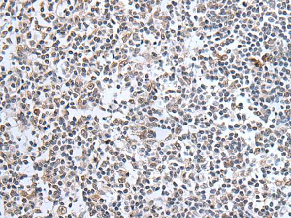 Rabbit Polyclonal Antibody to SULF2