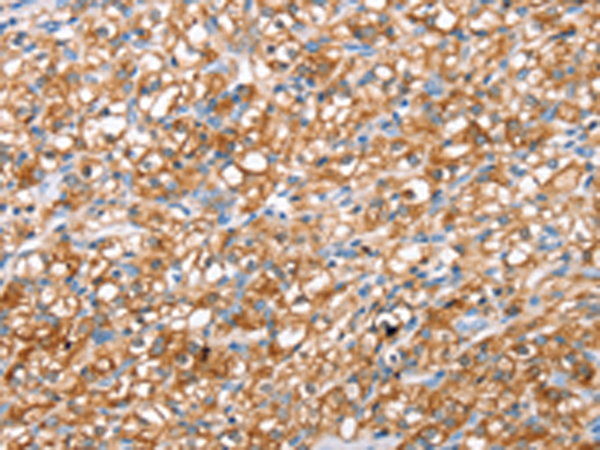 Rabbit Polyclonal Antibody to ABCC8