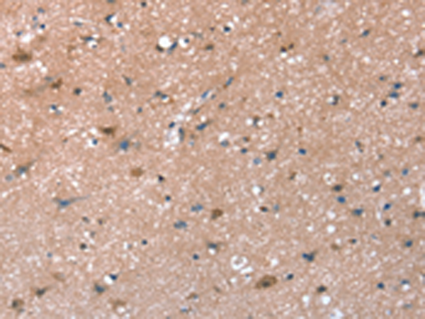 Rabbit Polyclonal Antibody to SYNPO