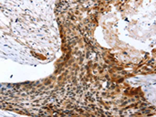 Rabbit Polyclonal Antibody to SYNPO2