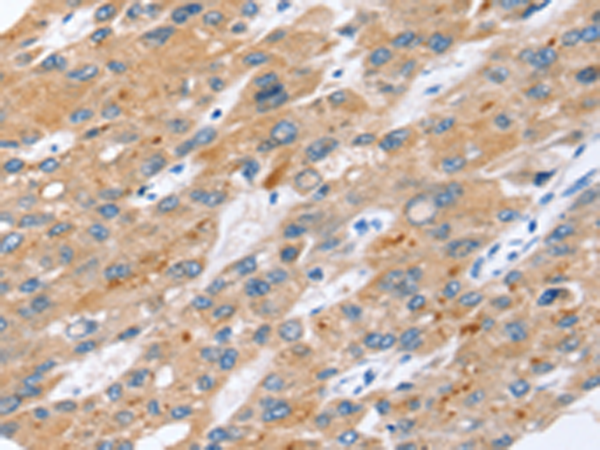 Rabbit Polyclonal Antibody to ERVW-1