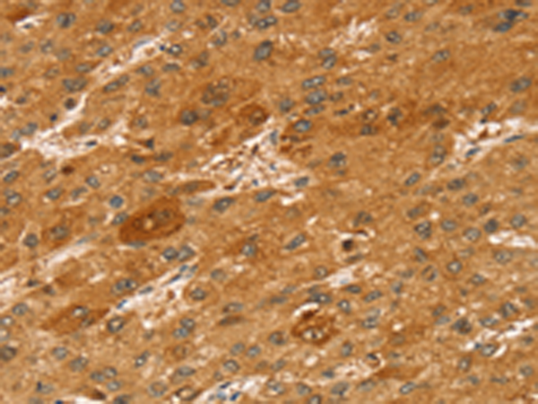 Rabbit Polyclonal Antibody to STX2