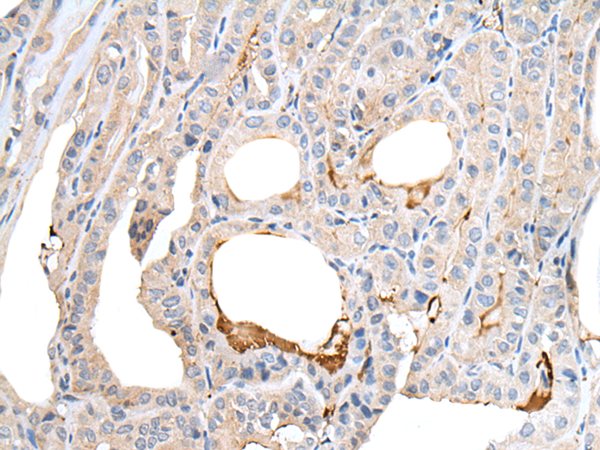 Rabbit Polyclonal Antibody to GPR15