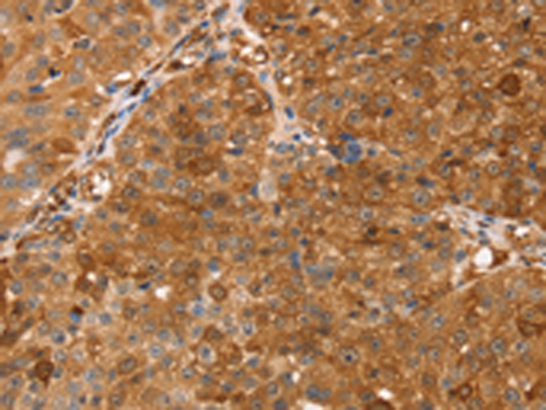 Rabbit Polyclonal Antibody to TMSB10