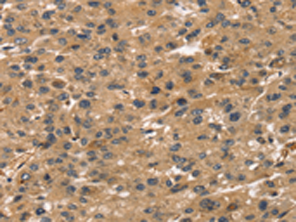 Rabbit Polyclonal Antibody to TMSB4X