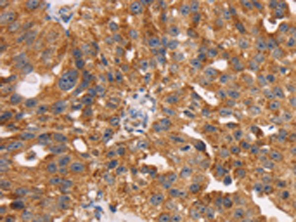 Rabbit Polyclonal Antibody to TM4SF1