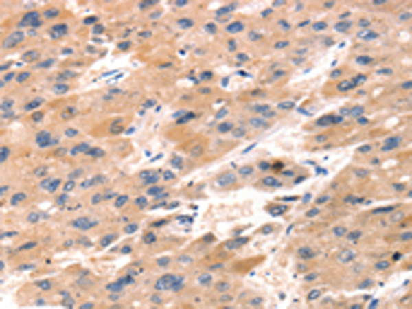 Rabbit Polyclonal Antibody to TAP2