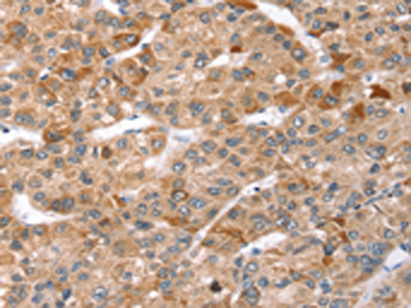 Rabbit Polyclonal Antibody to TBC1D1
