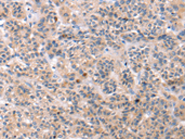 Rabbit Polyclonal Antibody to TCERG1L