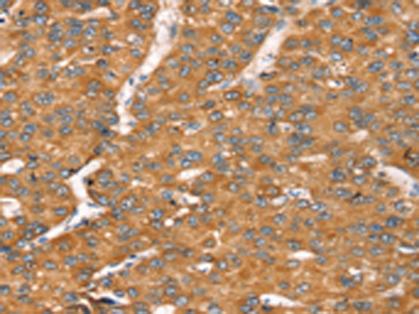 Rabbit Polyclonal Antibody to TGFB2