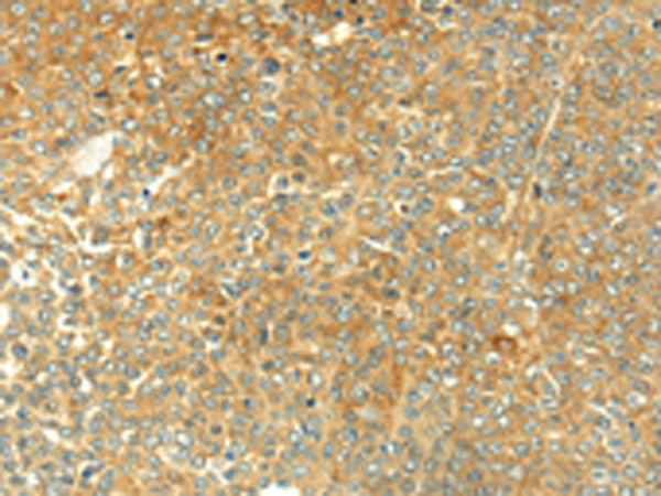 Rabbit Polyclonal Antibody to TGM5