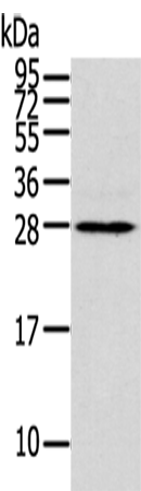 Rabbit Polyclonal Antibody to THAP3