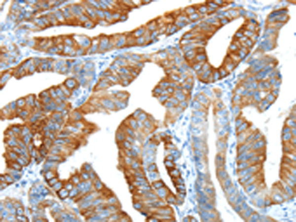 Rabbit Polyclonal Antibody to F2