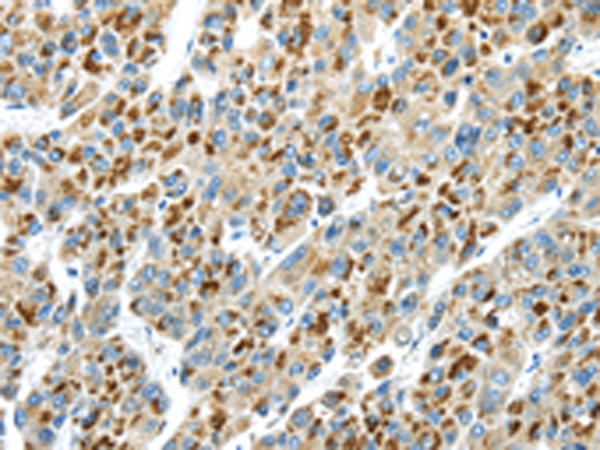 Rabbit Polyclonal Antibody to THBS2