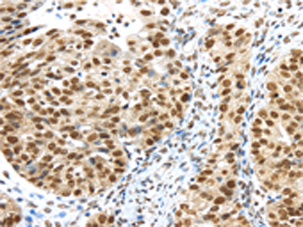 Rabbit Polyclonal Antibody to TRIM33