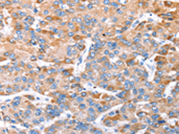 Rabbit Polyclonal Antibody to TRIM14