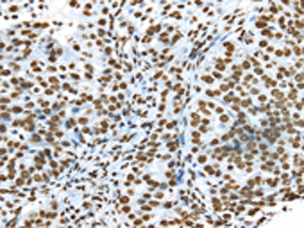Rabbit Polyclonal Antibody to TRIM27