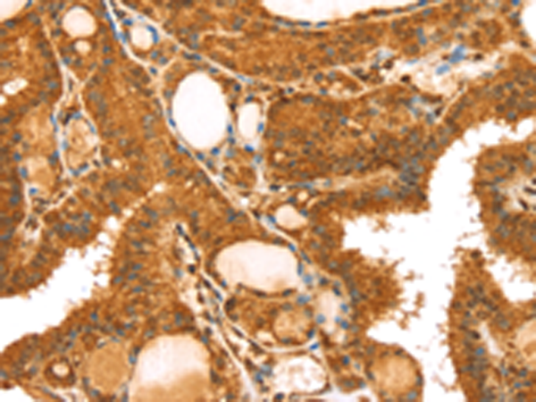 Rabbit Polyclonal Antibody to TRIM25